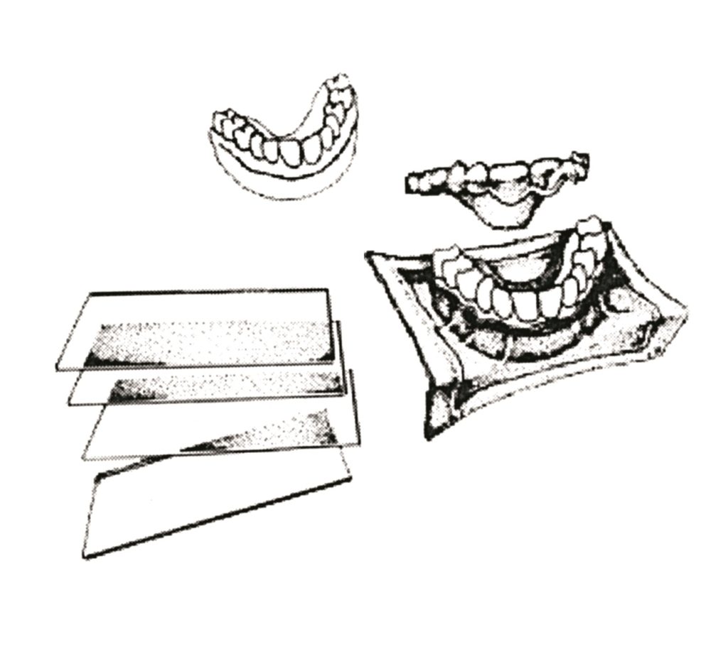 Retainer Plastic OrthoSourceGlobal