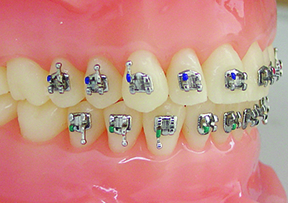 Low Profile Standard